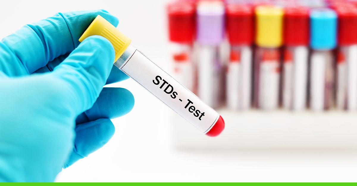 STD testing