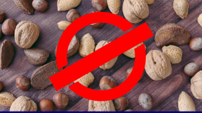 Tree nut allergies